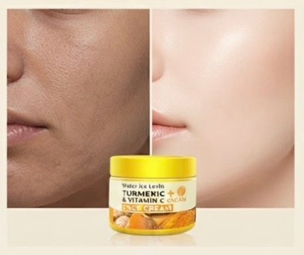 Turmeric & Vitamin C Anti-Aging Cream | Brightening, Firming & Deep Moisturizing · 50g